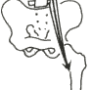 psoas.png
